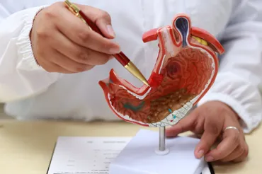 例を超える胃の手術経験を持つ外科医が語る、胃がんの手術で「胃の全摘出」はしないほうがいいこれだけの理由(集英社オンライン)