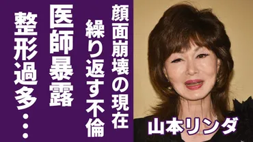 山本リンダの医師が暴露した多すぎる整形顔面崩壊した現在の