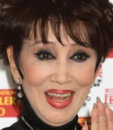 浅丘ルリ子さんの前歯や歯並び（八重歯解消） 