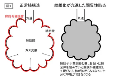 美空ひばりの生涯と歌声の軌跡：歌姫の死を巡る病と、名曲『川の流れのように』に込められた想いとは？美空ひばりの病と、彼女を支えた歌