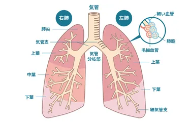 肺がんとは？種類、原因、症状、治療法を徹底解説！肺がんの基礎知識から最新治療まで