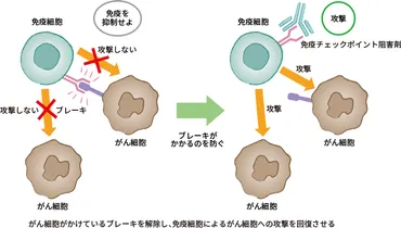 肺がんの免疫チェックポイント阻害剤（免疫療法）の特徴と種類・副作用