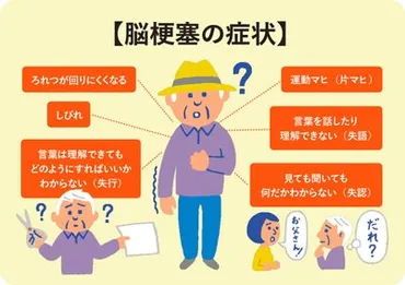 脳梗塞、早期発見が重要？原因、症状、予防法を徹底解説！脳梗塞のサインを見逃さないために