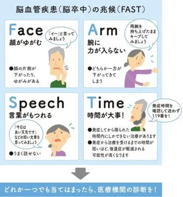 脳卒中のサインは「FAST」と覚えましょう!
