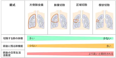 肺がん 非小細胞肺がん 治療:国立がん研究センター がん情報サービス 一般の方へ