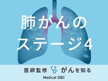 肺がんのステージ4」の症状・余命・生存率はご存知ですか？医師が解説！ 