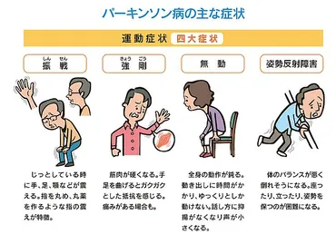 パーキンソン病とは？原因・症状・治療法を解説！(パーキンソン病、治療、症状？)パーキンソン病の基礎知識：原因、症状、治療法