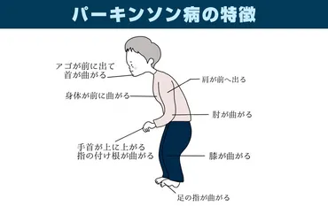 パーキンソン病のリハビリと目的 