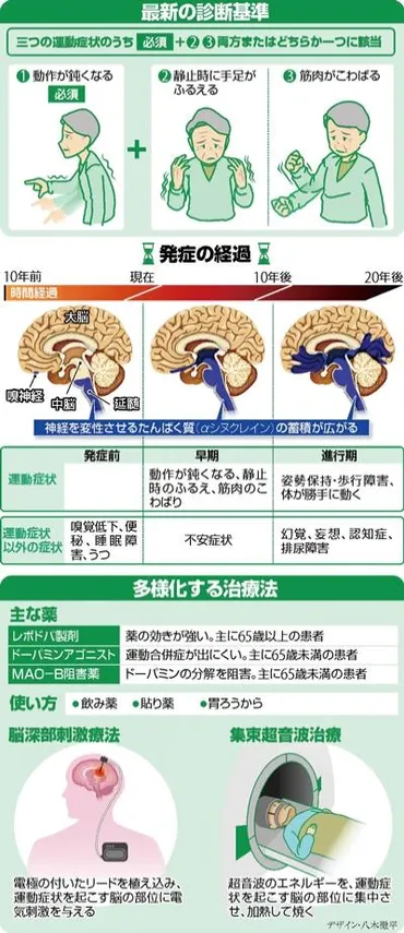 パーキンソン病、早期治療で進行抑える…診断基準見直し 