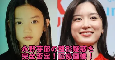 永野芽郁の整形疑惑を完全否定する証拠画像!顔の変化や目・鼻を子役時代から徹底検証!