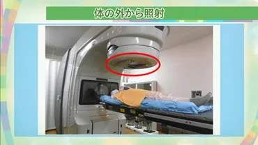 女性が気になるがん 「最新放射線治療」